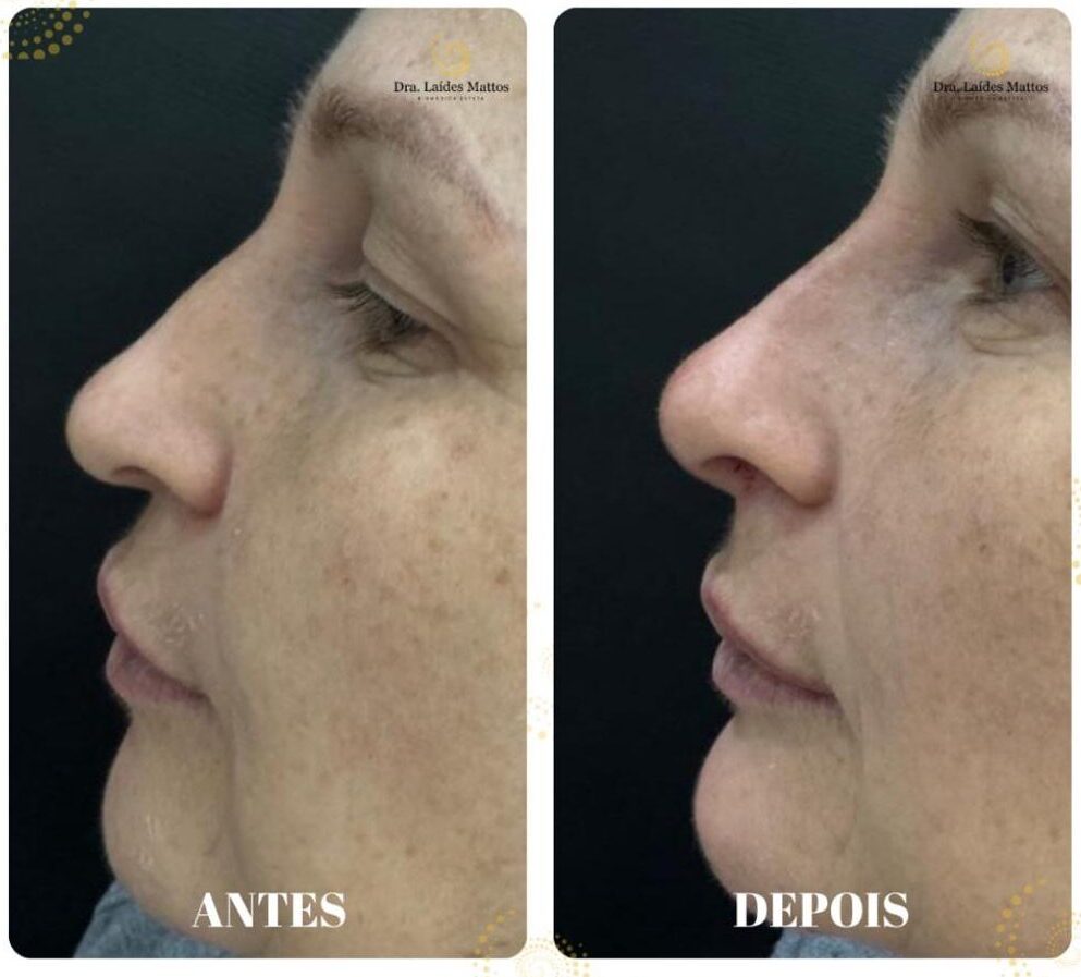 Imagem do WhatsApp de 2025-10-17 à(s) 16.09.13_633640a9